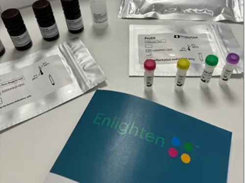 Image: The Enlighten test detects early-stage cancers by focusing on the body\'s response to tumor development (Photo courtesy of Proteotype Diagnostics)